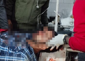Road Accident
